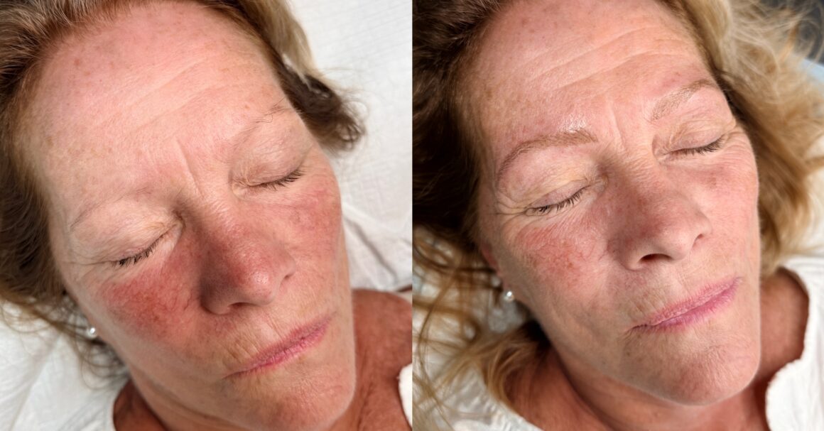 Before and after Nano Brows showing restored brow shape and natural-looking definition on a mature client at Urban Oasis Nashville.