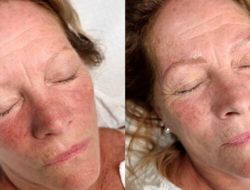 Before and after Nano Brows showing restored brow shape and natural-looking definition on a mature client at Urban Oasis Nashville.