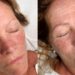 Before and after Nano Brows showing restored brow shape and natural-looking definition on a mature client at Urban Oasis Nashville.